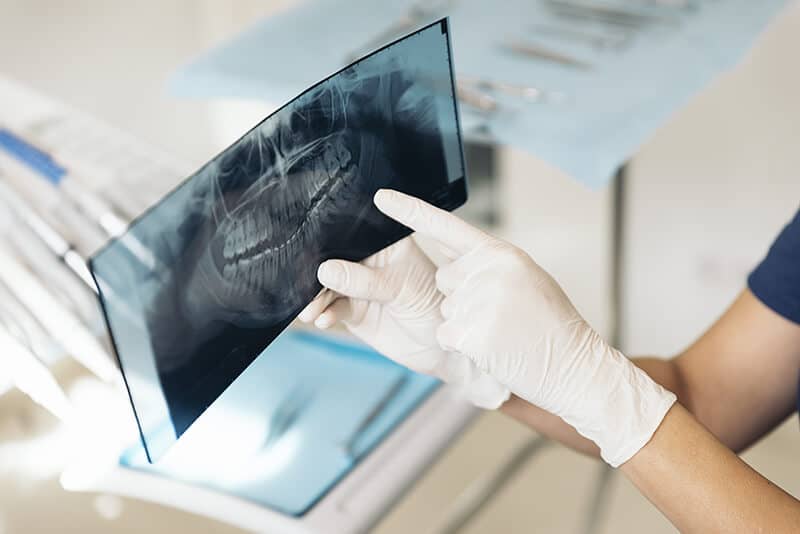 dental-x-ray.jpg